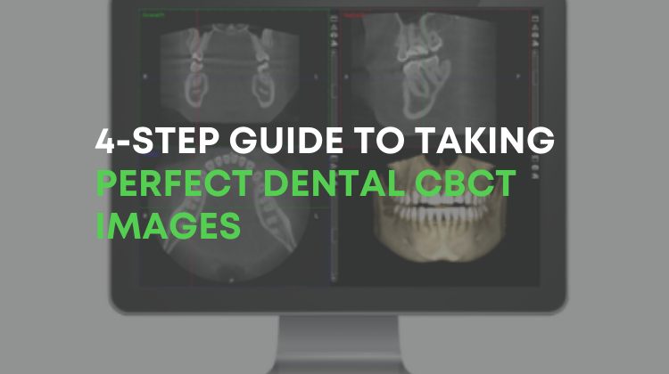 How to take perfect dental CBCT images