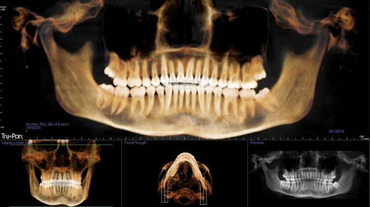 orthodontic cbct