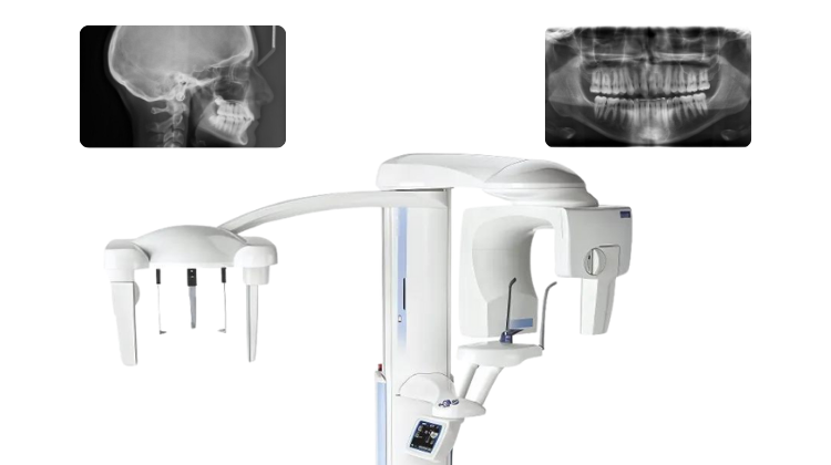 ceph upgradeable dental x-ray machine