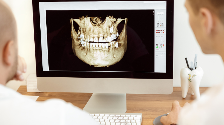 dental 3d imaging