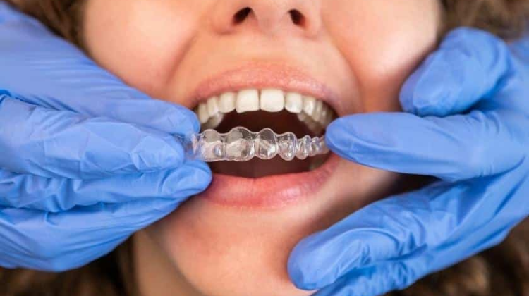 invisalign treatment