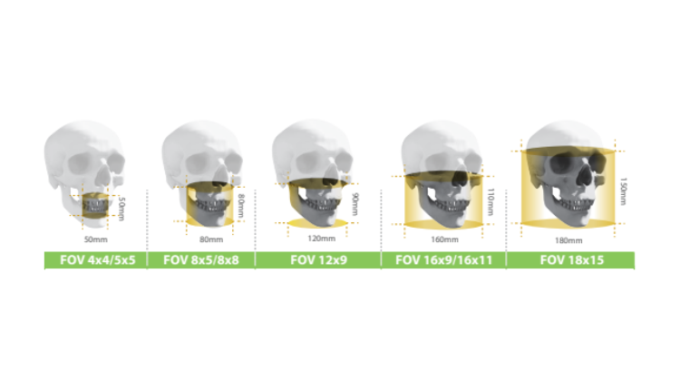 dental cbct field of view sizes