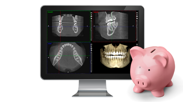 how much does a cbct scan cost