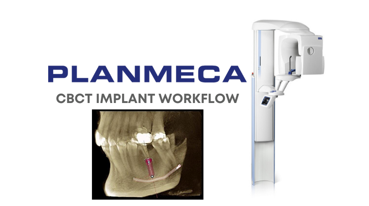 Planmeca CBCT Implant Workflow