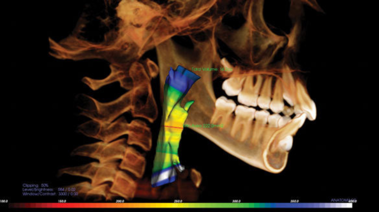 cbct for airway studies