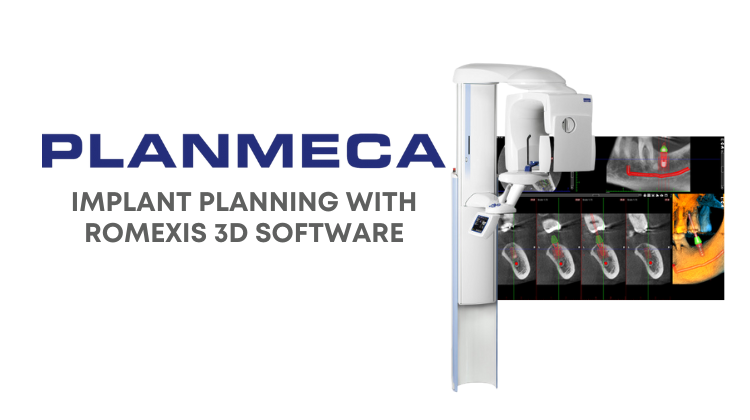 Planmeca Romexis 3D software