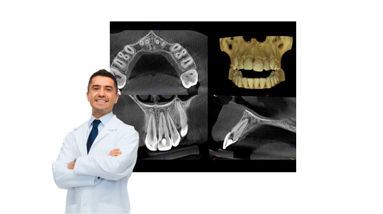 dental cone beam for endodontics