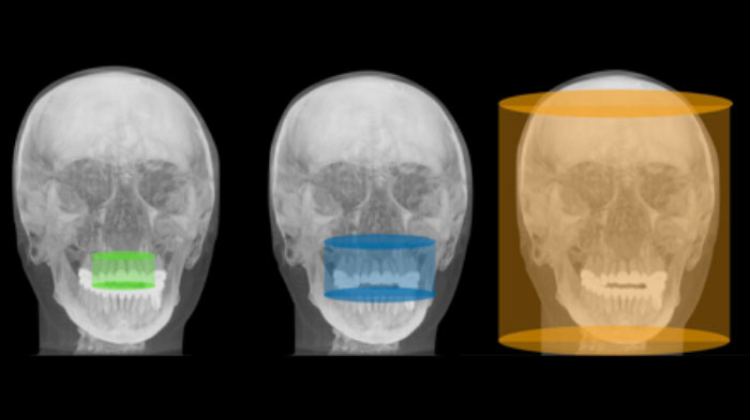 CBCT field of view