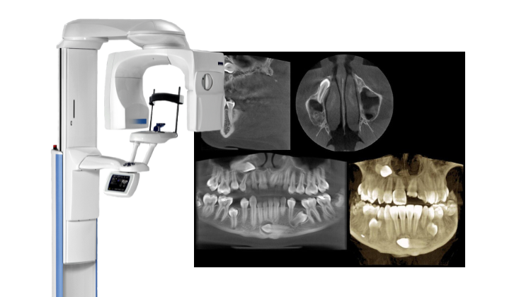 Planmeca Promax 3d
