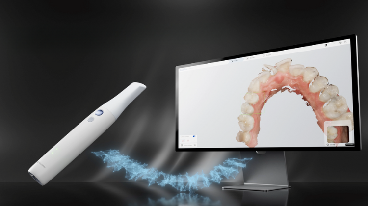 alliedstar sensa wireless intraoral scanner
