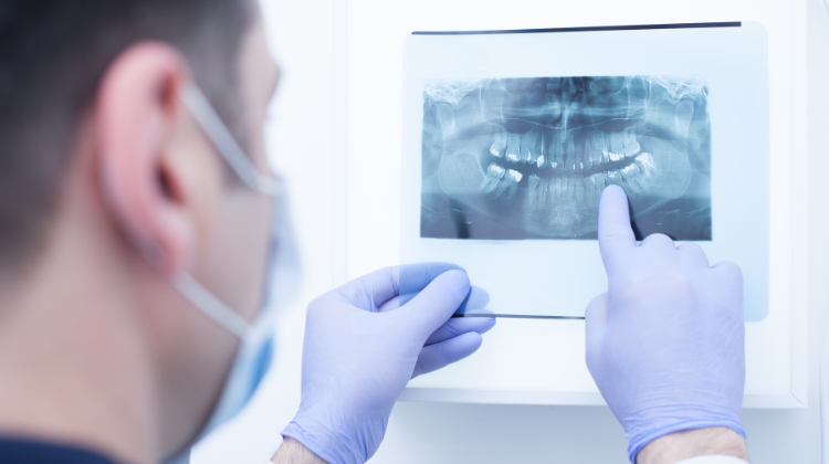 Film Dental X-Ray