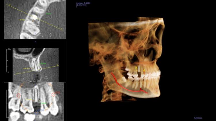 cbct scan