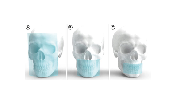 small medium large field of view cbct