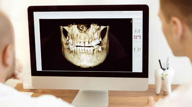 i-cat CBCT scan