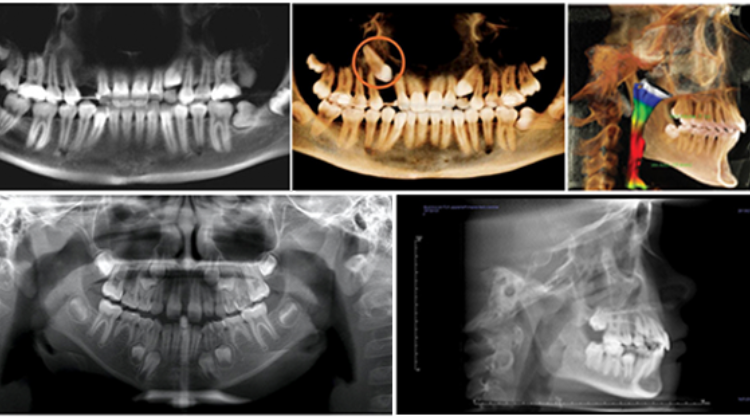 dental cone beam imaging