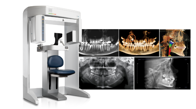 i-cat cbct