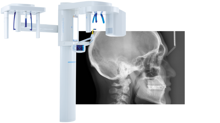 sirona pan ceph x-ray machine