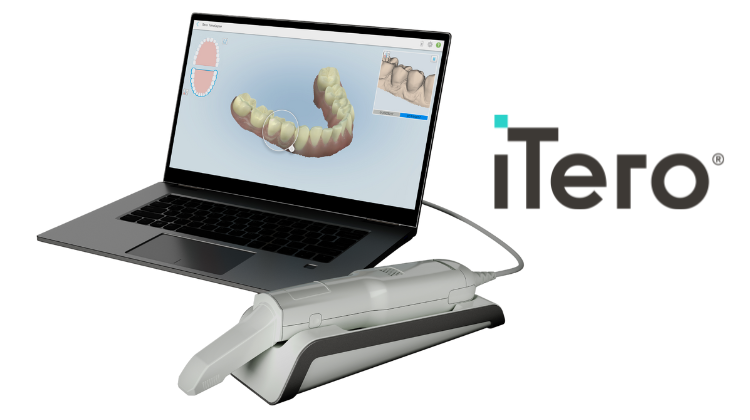 itero element scanner