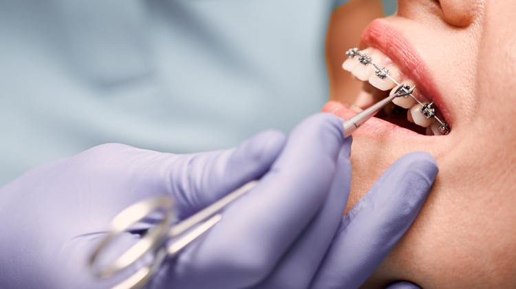 orthodontic equipment
