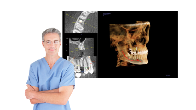 cbct for oms oral surgery