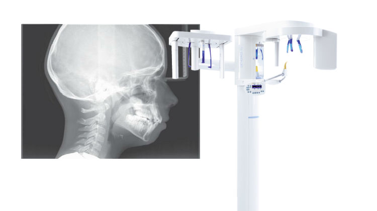 Cephalometric X-Ray Machine