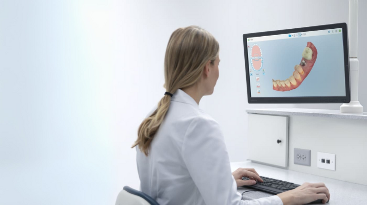 itero scanner